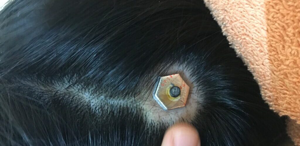 円形脱毛症への鍼灸